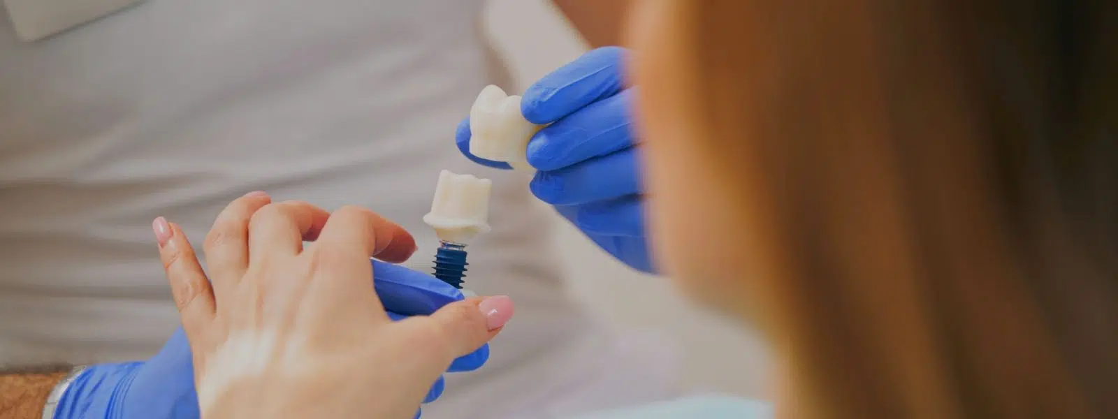 como saber si tu implante dental está fallando portada
