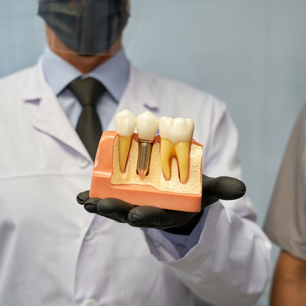 Beneficios para la salud de los implantes dentales